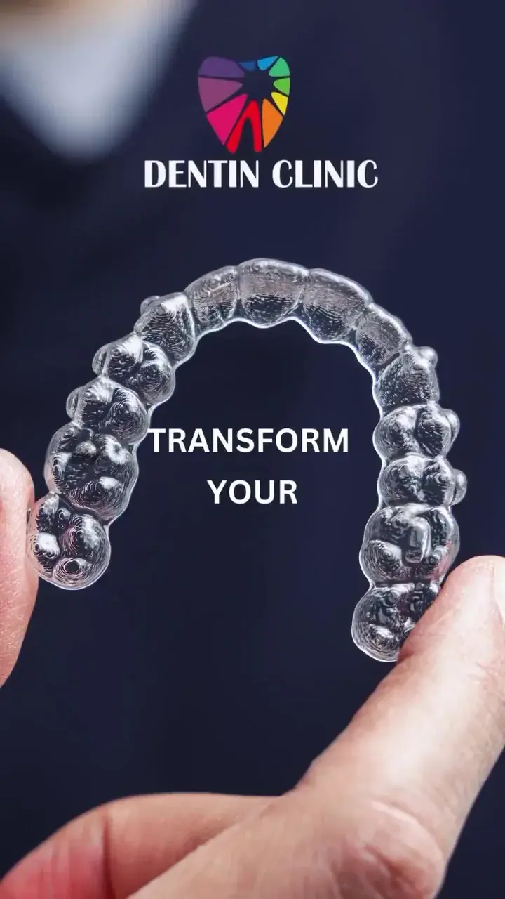 Illusion clear aligners available at DENTIN in HSR Layout